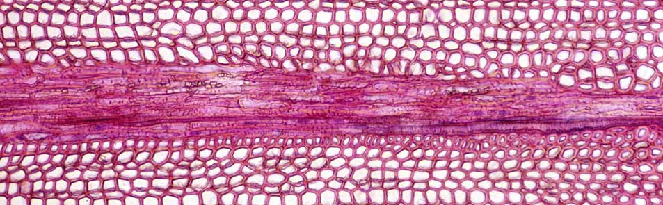 Cross section with a ray